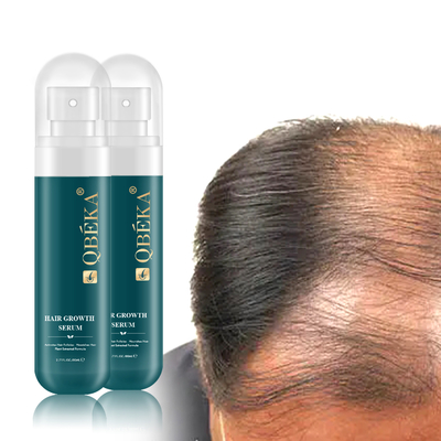 80 ml pflanzliches Haarverlust- und Haarwachstumsserum zur Verhinderung von Haarausfall