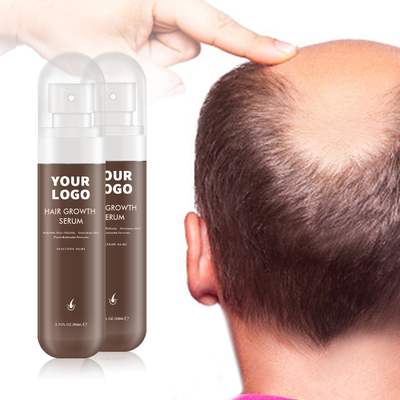 100% reiner Pflanzenextrakt Formel Kopfhaut Serum Feuchtigkeitscreme für starke und gesunde Kopfhaut