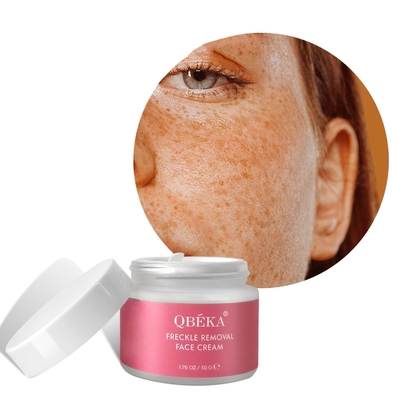 Retinol-Gesichtscreme zur Freckelentfernung angepasste Duft und Privatetikett angeboten