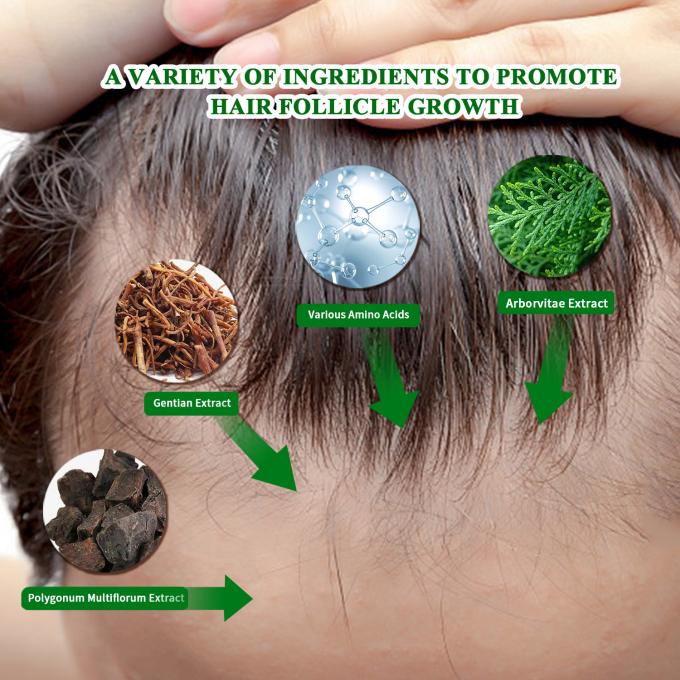 Bio-Haarwachstumsserum Externer Gebrauch Haarwiederwachstum Behandlung gegen Haarausfall Spray 80 ml 0