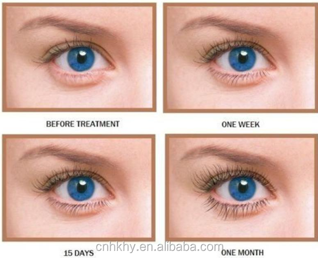 Erleben Sie längere Wimpern mit Bio-Enzymen Wimpernwachstum Serum Haltbarkeit 3 Jahre 1