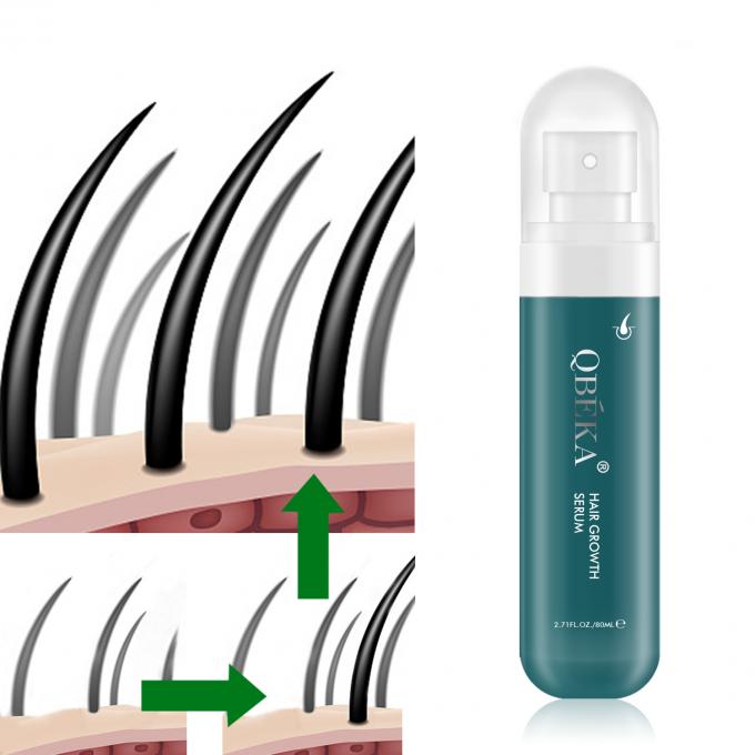 80 ml Haarwachstumsöl Private Label Produkt Profi QC Team Anti Haarausfall Serum 0