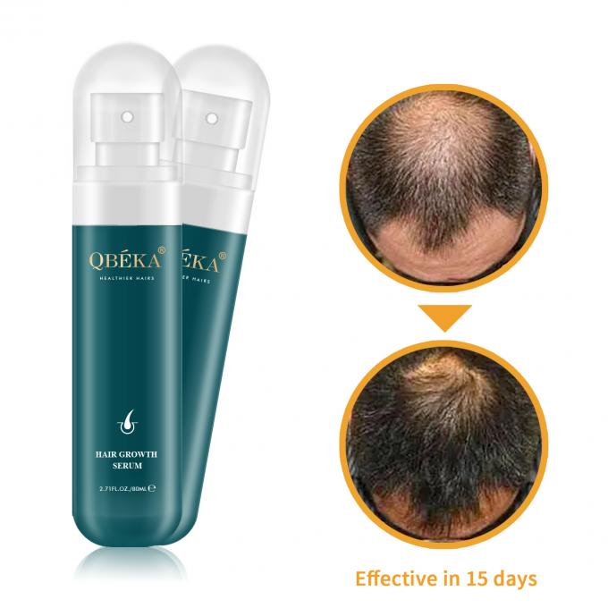 80 ml Haarwachstumsöl Private Label Produkt Profi QC Team Anti Haarausfall Serum 1