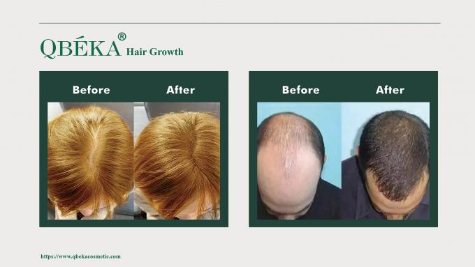 GMPC Standard 80ml Serum Das ultimative Heilmittel gegen Alopezie 10