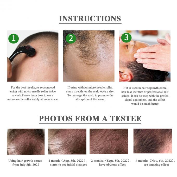 Kräuter 7-15 Tage Haarwachstumsserum Volumen und Glanz an Ihrem Haar mühelos wiederherstellen 3