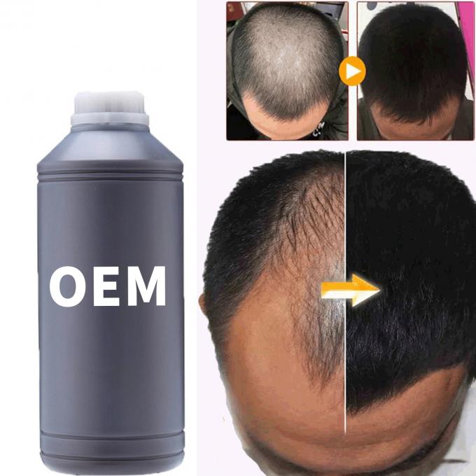 36 Monate Haltbarkeit Haarwachstum Booster Öl Serum für alle Haartypen Haarausfall Pflege 3
