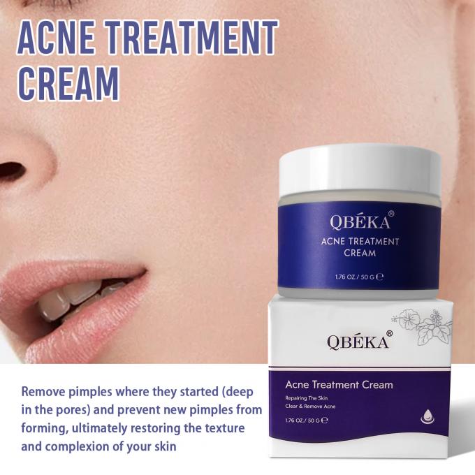Natürliche Bio-Acne-Behandlung Creme Menge 1000 2