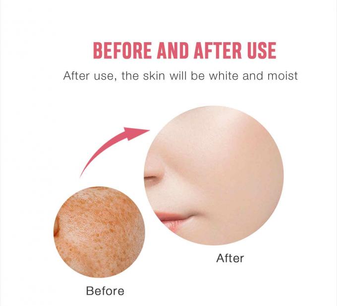 Freckle Removal Face Cream auf Glycerinbasis für OEM/ODM Hautpflegeprodukte Private Label 8