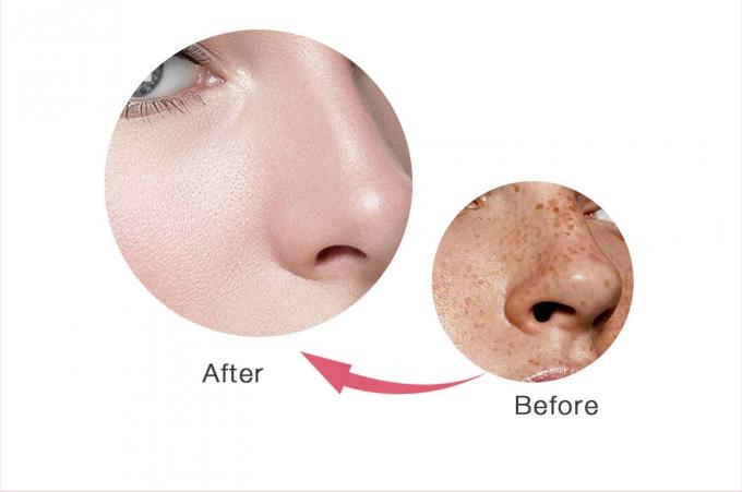 Freckle Removal Face Cream auf Glycerinbasis für OEM/ODM Hautpflegeprodukte Private Label 9