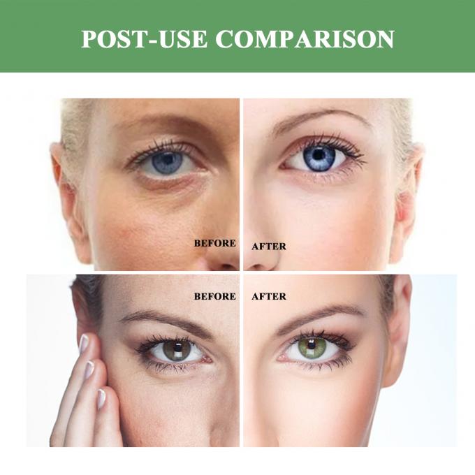 Regelmäßige Größe Anti-Aging Feuchtigkeitscreme Bio-natürliche Faltenlöschcreme für Erwachsene 7