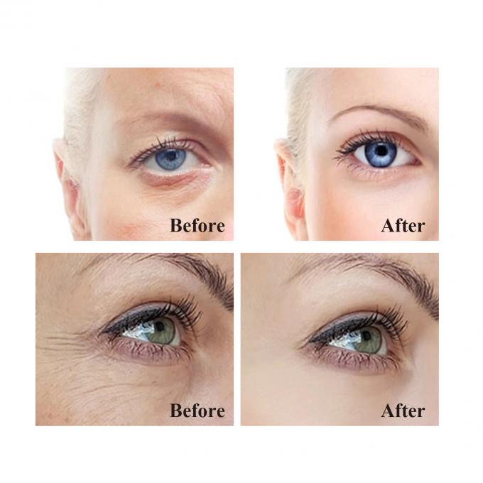 OEM-Festung Vitalität Augencreme Ihre geheime Waffe gegen alternde Augen und dunkle Ringe 9