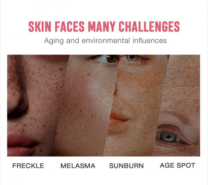 Freckle Removal Face Cream auf Glycerinbasis für OEM/ODM Hautpflegeprodukte Private Label 6