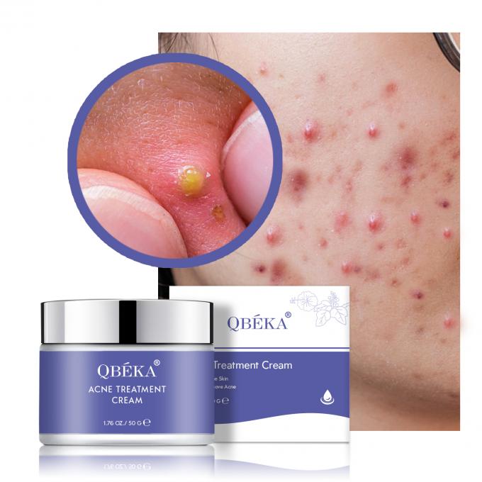 Aknecreme Dunkle Flecken Kräuter Set Vitamin C verblasst Narben für die Revitalisierung der weiblichen Haut 0