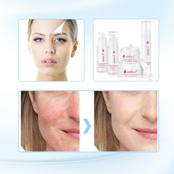 Fade Hyperpigmentation Feuchtigkeitsspendende und leuchtende Gesichtscreme mit einer Haltbarkeit von 3 Jahren 2