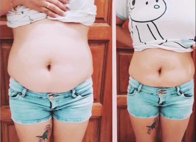 Bein- und Handschlankheitscreme 100000pcs Fett entfernende Creme für Frauen Brustverkleinerung 3