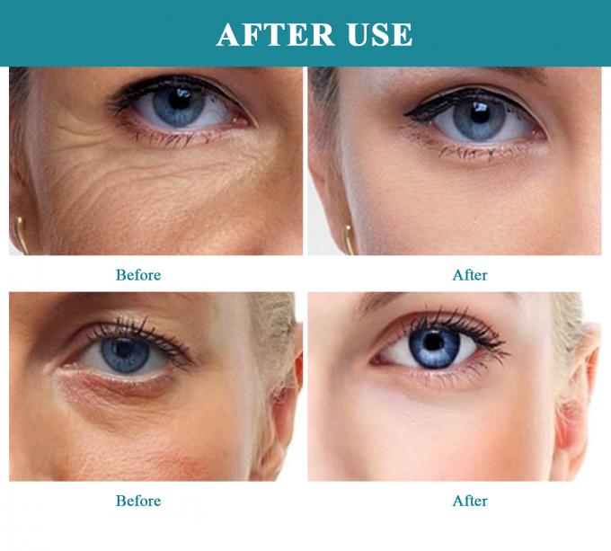 EYE 30 ml Hyaluronsäure-Multi-Effekt-Serum zur Hautpflege gegen Alterung in meiner Nähe 6