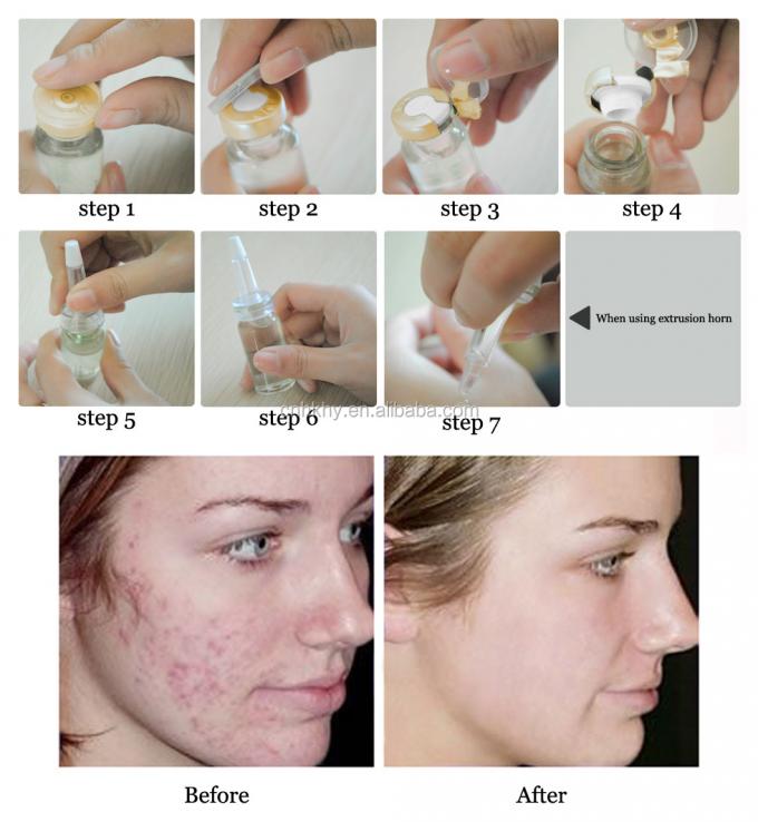 100% reines Vitamin Levorotatory VC Hautserum für Gesichtsbehandlung und Faltenbekämpfung 3