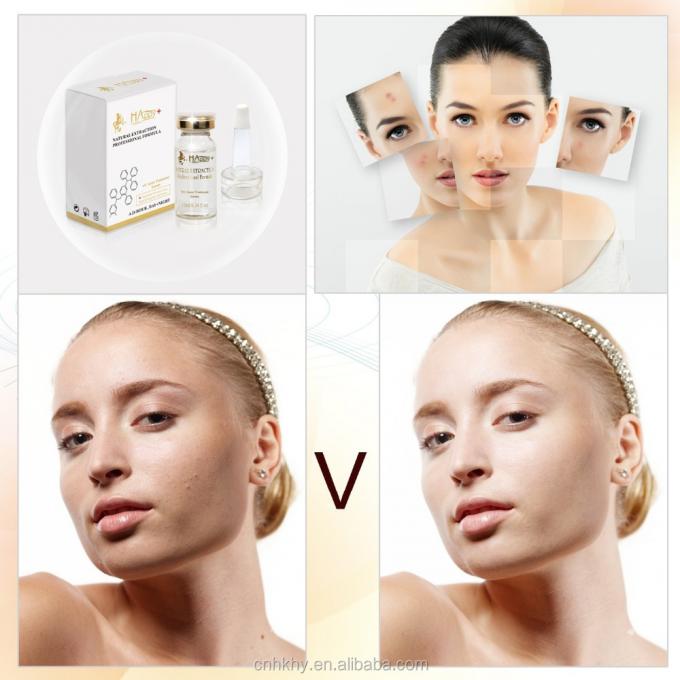 Entfernen Sie Akne Narben mit QBEKA Happy Cosmetics Levorotatory VC Original Liquid Bio Serum 0
